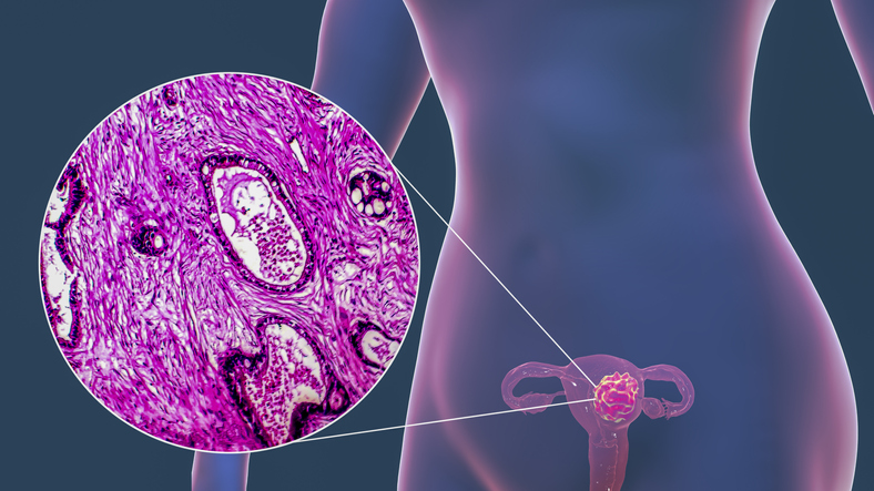 Gynaecology (Oncology)