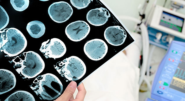 Neurology